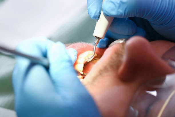 Best Emergency Tooth Extraction  in Pea Ridge, WV
